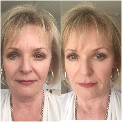 11+ Ideal Hairstyles For Older Thinning Hair