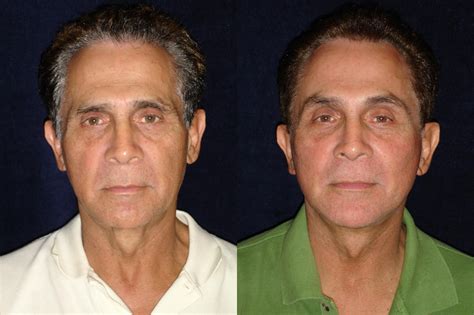 Kaiser Weight Loss Surgery Southern California at Clayton Cooper blog