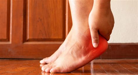 Plantar Fasciitis Physical Therapy - In Motion O.C.