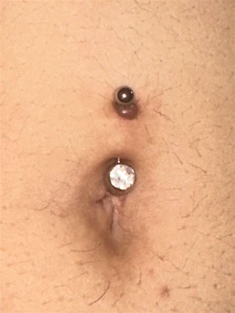 navel bump help!! is it a keloid?? : r/PiercingAdvice