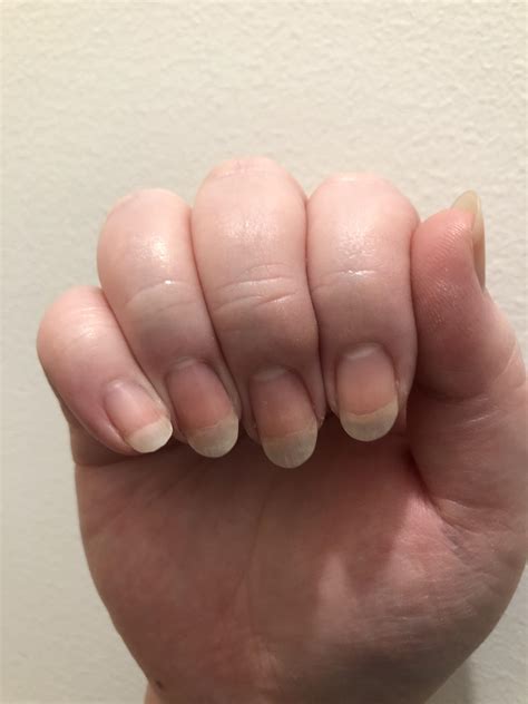 Curved Vs Flat Nail Bed at Luke Samantha blog