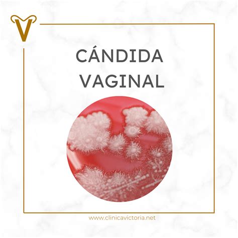CÁNDIDA VAGINAL - Clínica Victoria