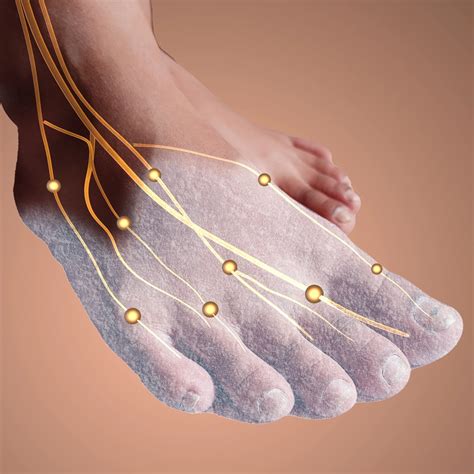 Diabetic Peripheral Neuropathy (DPN): Symptoms and Diagnosis