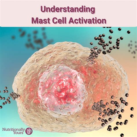 Understanding Mast Cell Activation | What Causes Mast Cell Activation?
