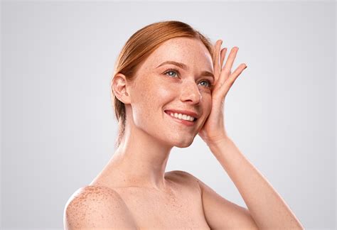 Lasers for Rosacea and Redness - Edmonton - Lucere