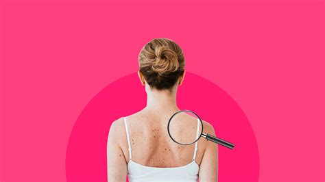 What does a dermatologist do? Read before your next appointment