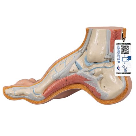 Hollow Foot (Pes Cavus) Model - 3B Smart Anatomy - SEM Trainers