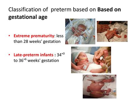 PPT - Preterm Baby PowerPoint Presentation, free download - ID:9166874