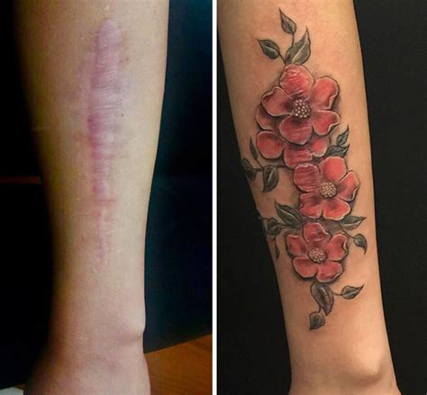 Forearm Scar Cover Up Tattoos