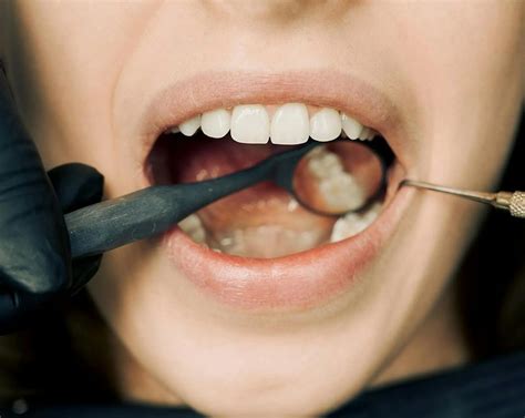 Understanding Tooth Extraction Healing Time Guide