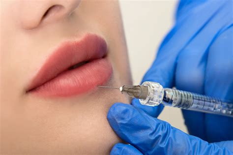 Lip Filler Administration: Hyaluron Pen vs Traditional Needle - Maylips