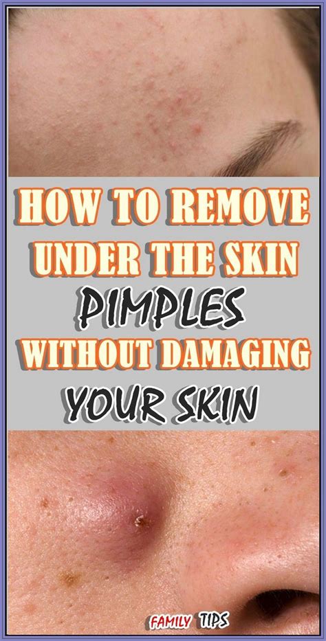 Pin on Low carb fruit