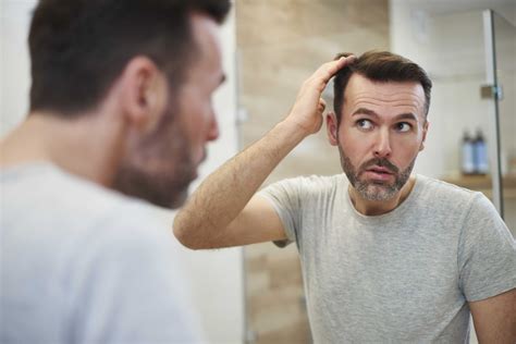 Can Hair Loss Be Reversed? Pattern Baldness & Alopecia | Evolve