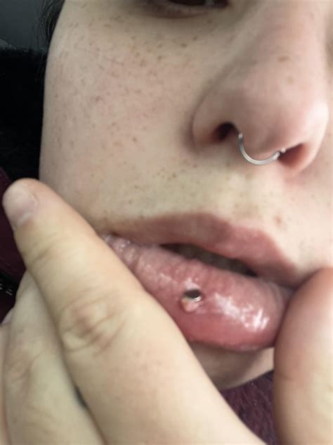Bump inside lip on Ashley piercing : r/PiercingAdvice
