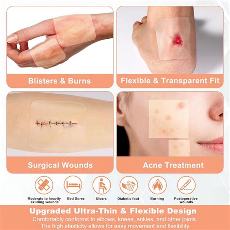 When To Stop Using Hydrocolloid Dressing