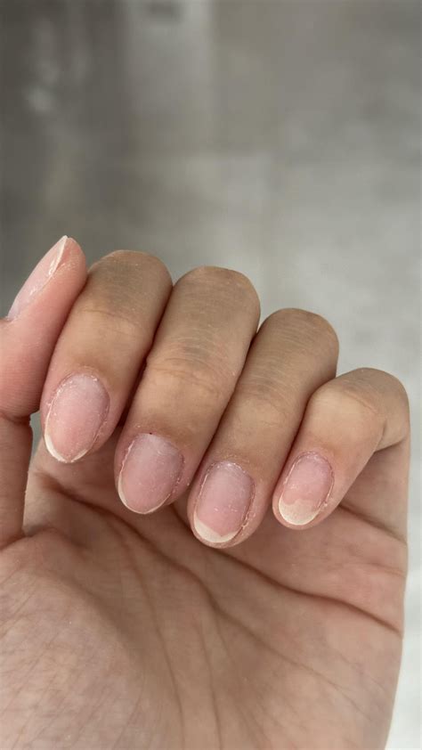 Help! My nail beds are receding/separating… : r/Nails