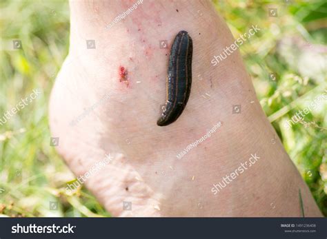 Leech Close Leech Bite Wound On Stock Photo 1491236408 | Shutterstock