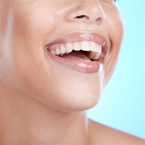 How To Properly Clean Your Dental Veneers - FriendHood Relationship Advice
