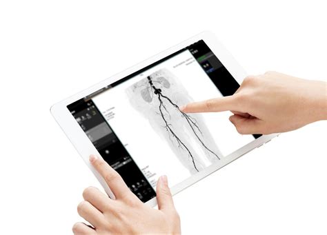 Magnetic Resonance Angiography NY | MRA Scan | AE