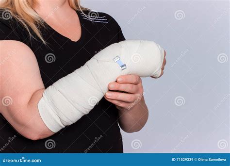 Finger Cast
