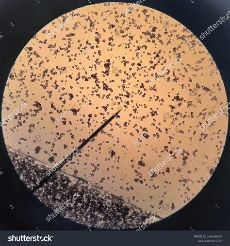 Maize Starch Granules Under Light Microscope Stock Photo 2261898009 ...