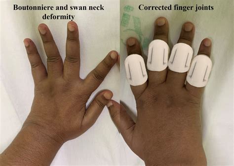 Boutonniere And Swan Neck Finger