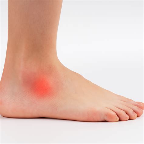 Pain on the Outside of Your Foot: Causes and Solutions