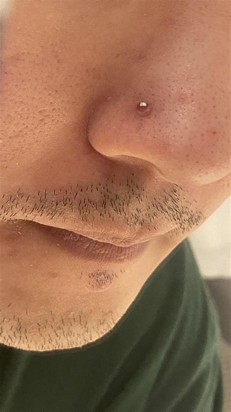 Nose piercings irritation bump : r/PiercingAdvice