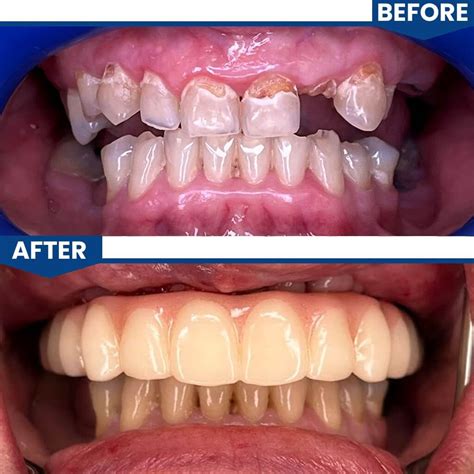 Smile Gallery | Central Valley Dentistry