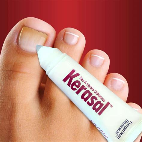 A Real and Honest Review of Kerasal Nail Renewal - Toe Fungus Journey