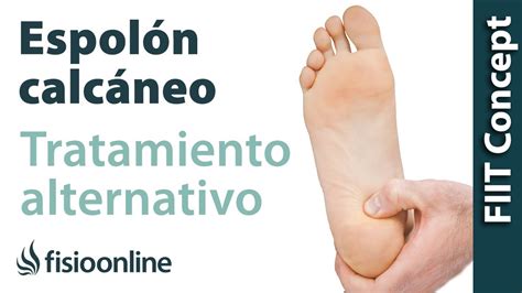 Espolón calcáneo - Visión desde la medicina natural - YouTube