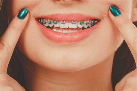 Cheek Biting: Causes, Treatments, and Long-Term Solutions