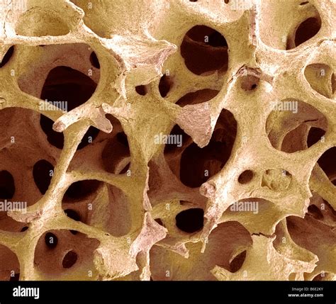 Spongy Bone Tissue Under Microscope at Milla Anstey blog