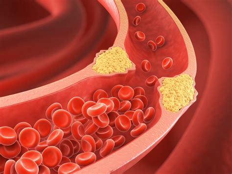 Cómo reducir el colesterol sin medicamentos: el consejo de los especialistas