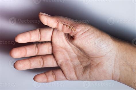 Hand Cut Stitches