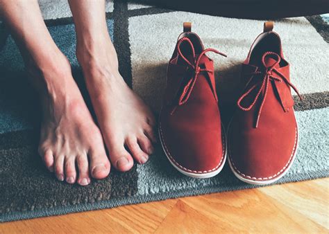 Juanetes en los pies: causas y consejos para la prevención de los pies - Blog Spain