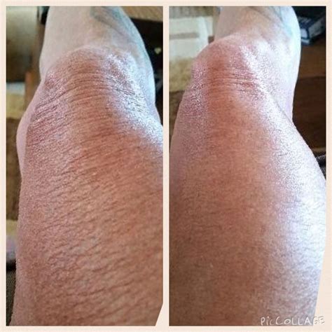 best lotion for crepey skin on arms and legs uk - Sid Aguiar