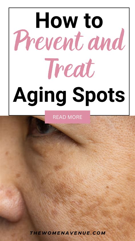 How to Prevent and Treat Aging Spots - Naturally | Age spots on face, Age spots, Red spots on face