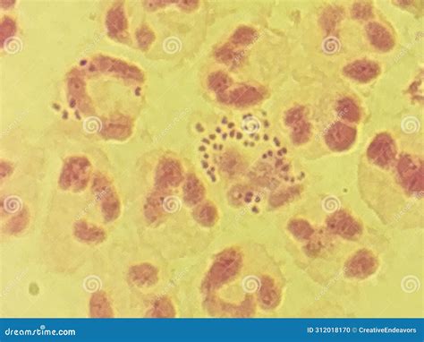 Neisseria Gonorrhea - Intracellular Gram Negative Diplococci Stock ...