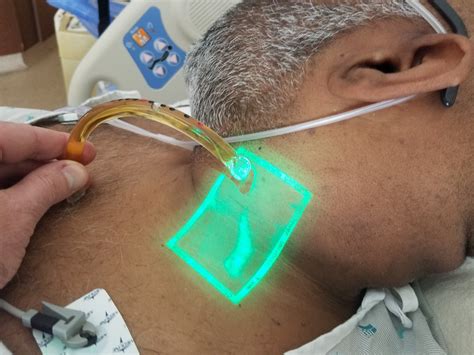 Does this patient have jugular venous distension? Vein finder‐enhanced assessment of jugular ...