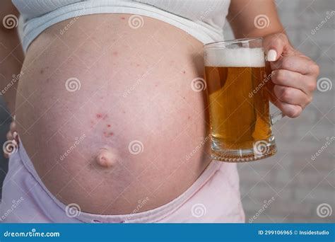 Faceless Pregnant Woman with Rash on Stomach Holding Glass of Beer ...