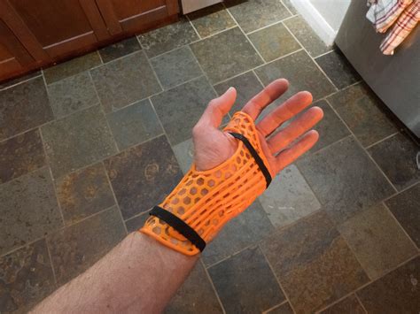 This 3d printed cast is revolutionizing how we heal broken bones – Artofit