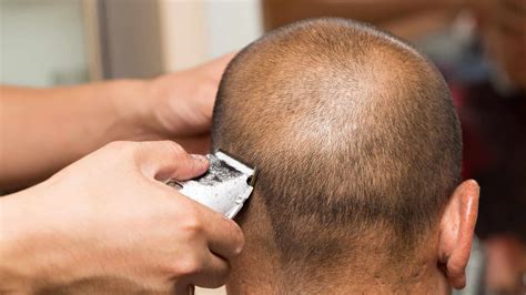 Impressive Tips About How To Treat Bump On Head - Yousew