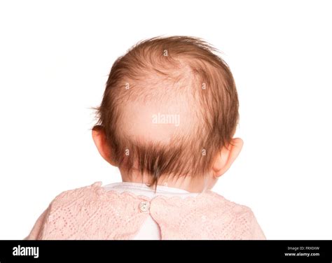 Bald head patch back hi-res stock photography and images - Alamy