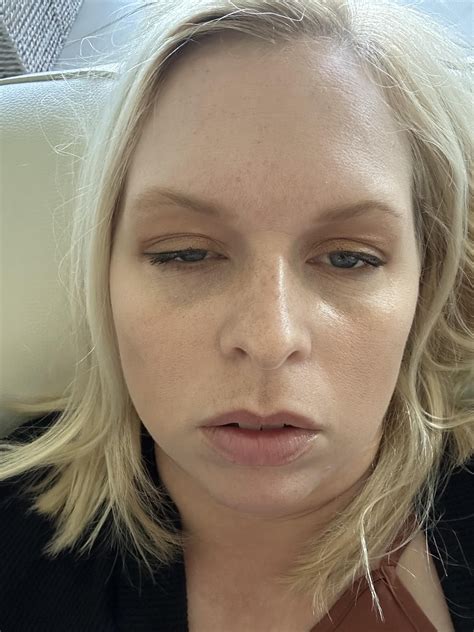 Bump on uvula. Anyone else ever have this? And what was it? : r/DiagnoseMe