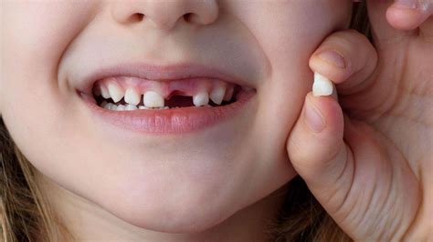 what does teeth falling out in a dream mean