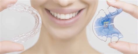 Tipos de retenedores dentales , uso y precio de estos