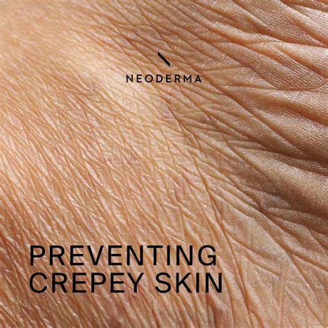 Preventing Crepey Skin – NEODERMA