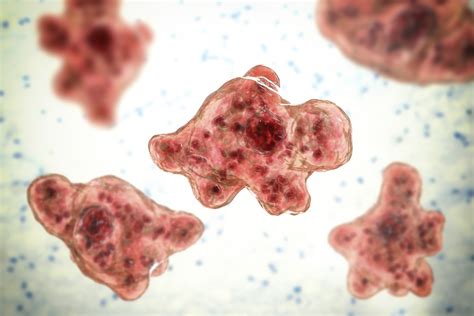 Brain-eating amoeba in tap water kills Texas woman: CDC | NewsNation