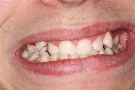 Before in 2025 | Art reference, Dental care, Teeth